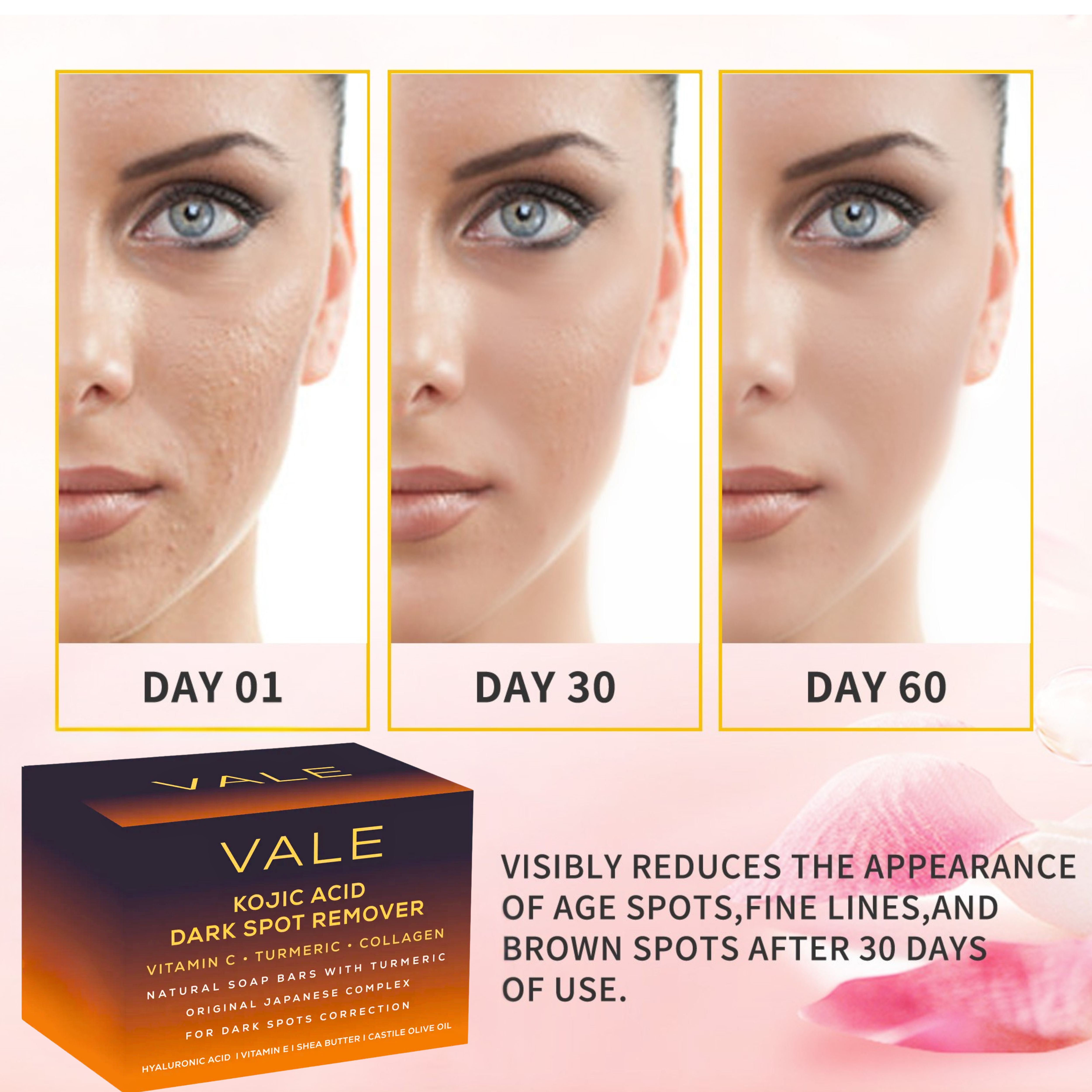 Vale Kojic Acid Soap